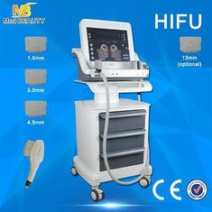 중국 800W 초음파 HIFU 기계 피부 관리 기계는 느슨한 피부를 바짝 죕니다 협력 업체